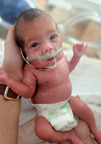 Two Tiny Miracles Born Seven Months Apart - CHRISTUS Health