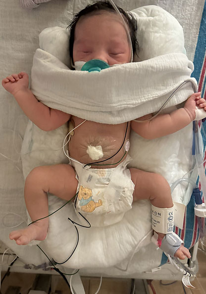 Newborn baby Heidi Canela is sleeping in the NICU with her pacifier in her mouth